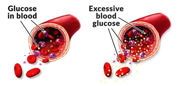 anti inflammation swelling – BLACK SEED OIL – cholesterol lower formula 3 BOTTLE