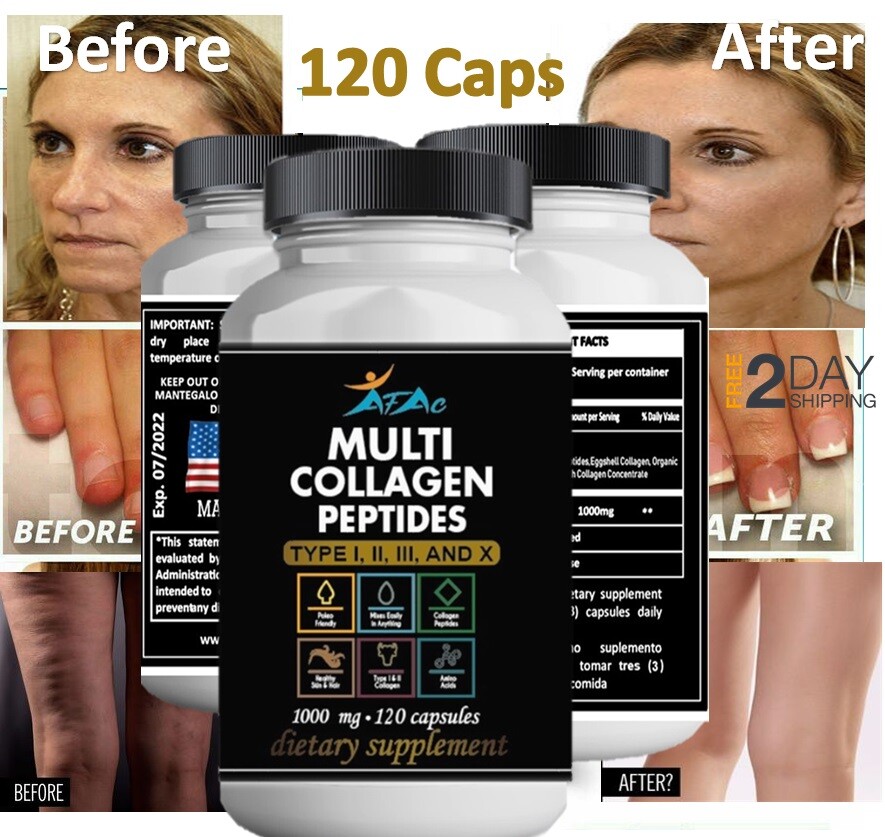 COLLAGEN HYDROLYZED FORT 120 CAPS COLAGENO HIDrolyzed PROTECT SKIN BONES MUSCLE