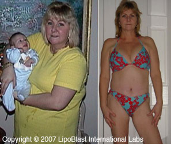 Extreme Fat Burner Pills Lose Weight Fast Diet Capsules Energy Booster Slimming
