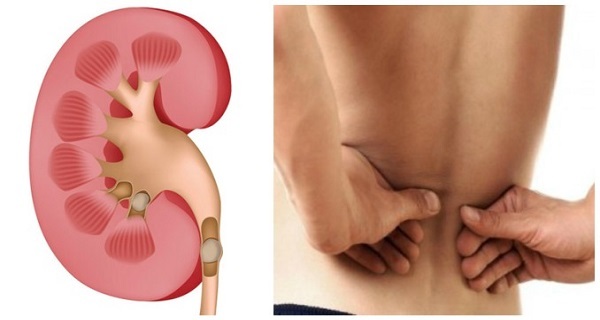 Healthy Urine – KIDNEY SUPPORT – Bladder Health – Kidney Boost – 3 B 180 Ct